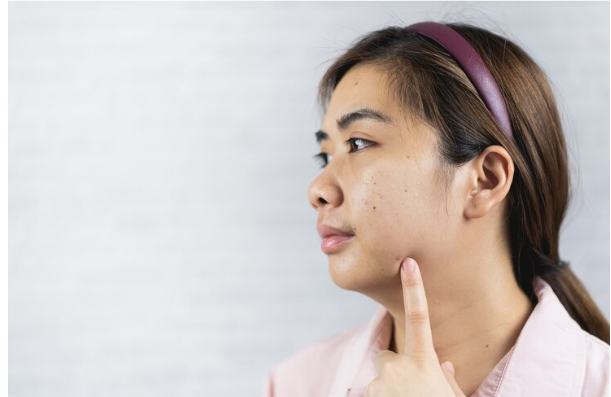 pelembab untuk kulit sensitif
